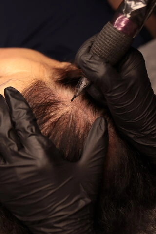 Maral performing scalp micropigmentation along the hairline in Richmond Hill